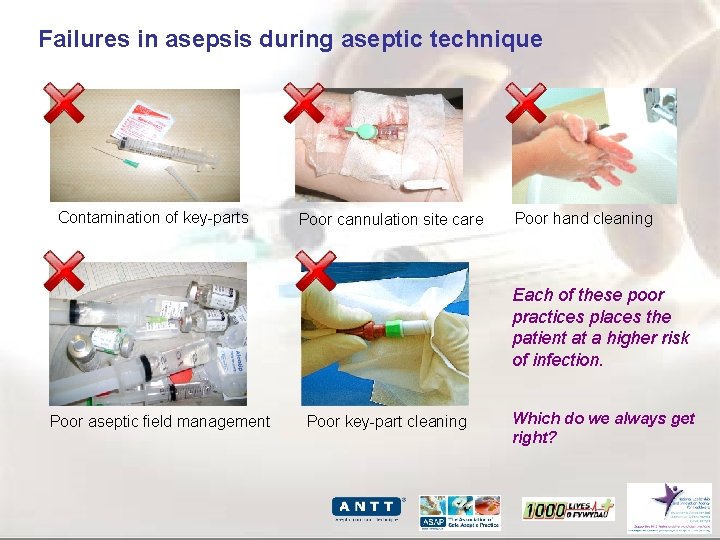 Failures in asepsis during aseptic technique Contamination of key-parts Poor cannulation site care Poor