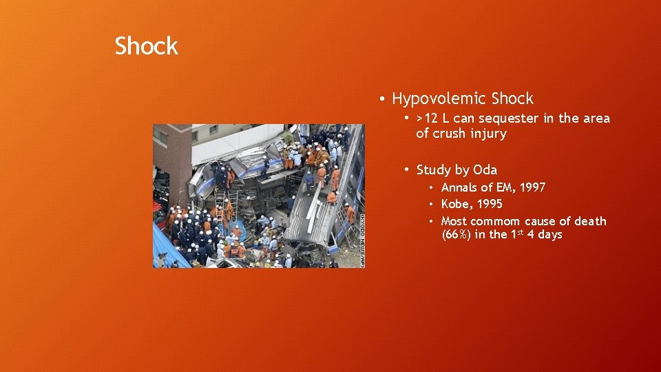 Shock • Hypovolemic Shock • >12 L can sequester in the area of crush