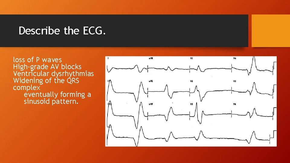 Describe the ECG. loss of P waves High-grade AV blocks Ventricular dysrhythmias Widening of