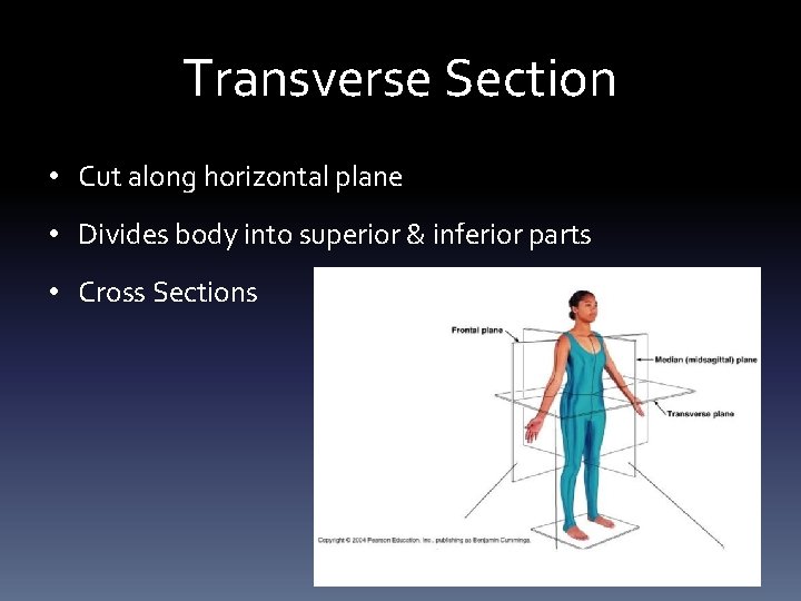 Transverse Section • Cut along horizontal plane • Divides body into superior & inferior