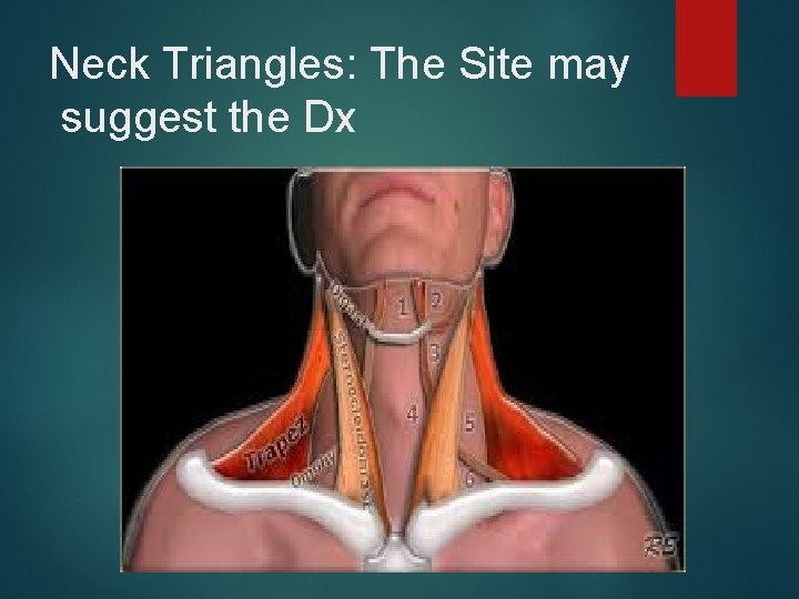 Neck Triangles: The Site may suggest the Dx 