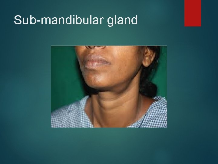 Sub-mandibular gland 