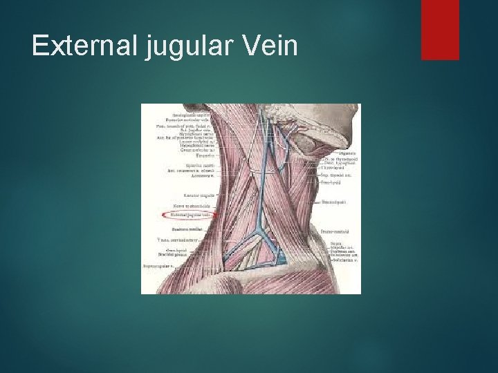 External jugular Vein 