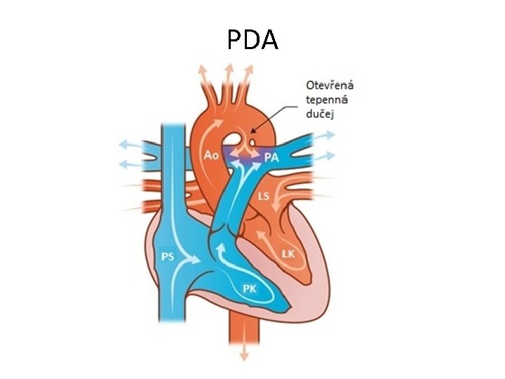 PDA 