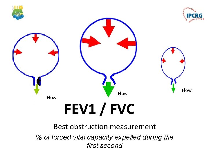 Airflow Flow FEV 1 / FVC Best obstruction measurement % of forced vital capacity