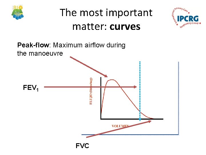 The most important matter: curves Peak-flow: Maximum airflow during the manoeuvre FEV 1 FVC