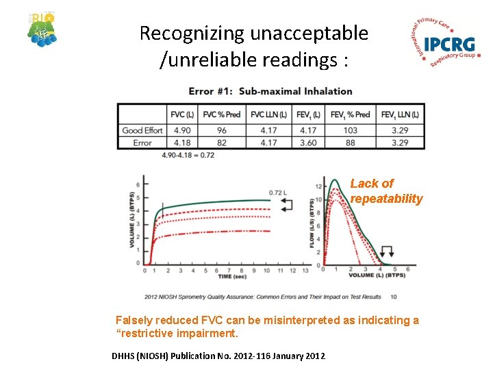 Recognizing unacceptable /unreliable readings : Lack of repeatability Falsely reduced FVC can be misinterpreted