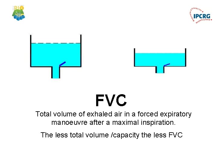 FVC Total volume of exhaled air in a forced expiratory manoeuvre after a maximal