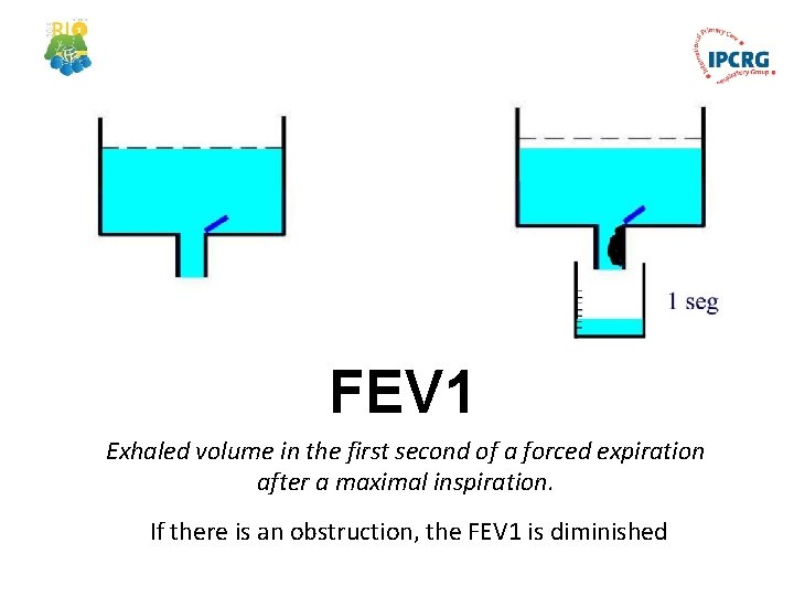 FEV 1 Exhaled volume in the first second of a forced expiration after a