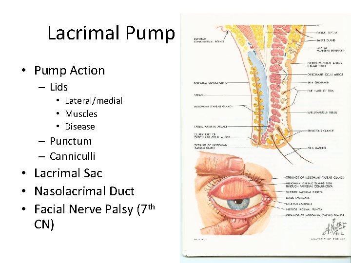 Lacrimal Pump • Pump Action – Lids • Lateral/medial • Muscles • Disease –