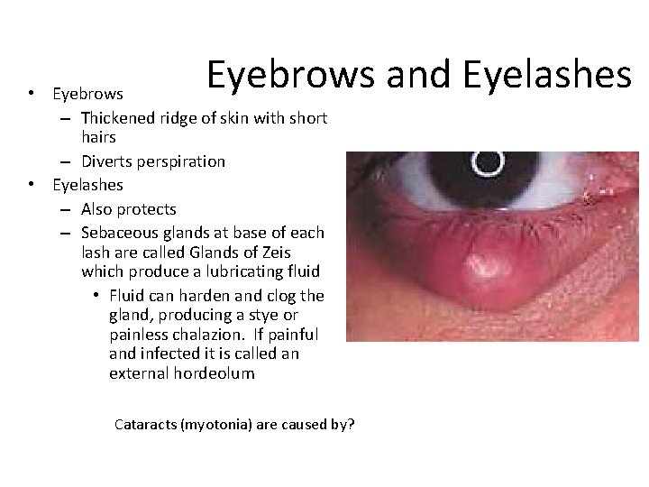 Eyebrows and Eyelashes • Eyebrows – Thickened ridge of skin with short hairs –
