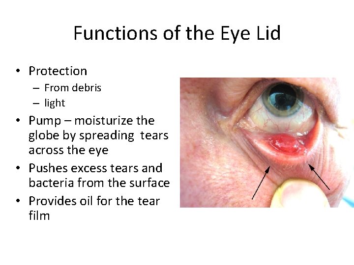 Functions of the Eye Lid • Protection – From debris – light • Pump