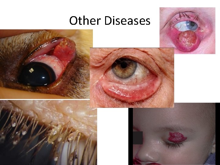 Other Diseases 