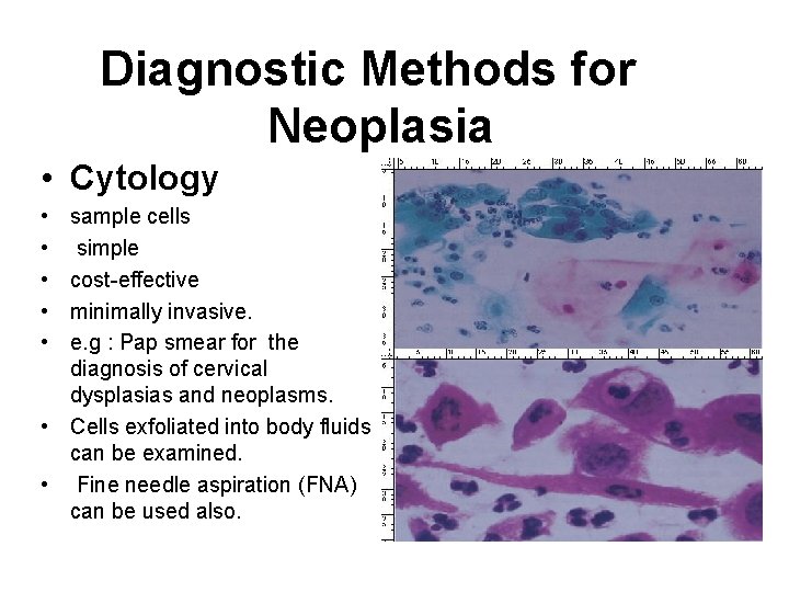 Diagnostic Methods for Neoplasia • Cytology • • • sample cells simple cost-effective minimally