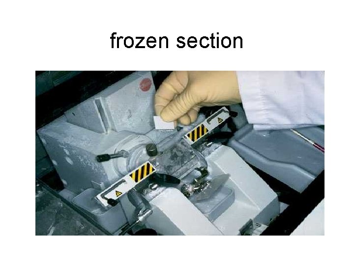 frozen section 