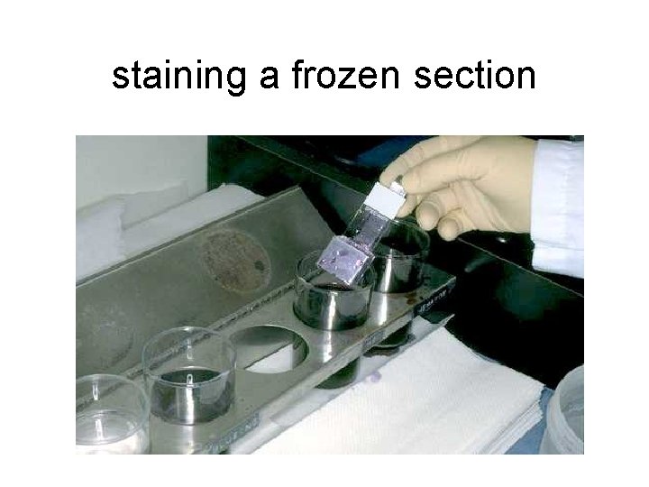 staining a frozen section 