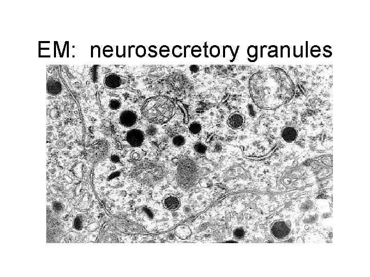 EM: neurosecretory granules 