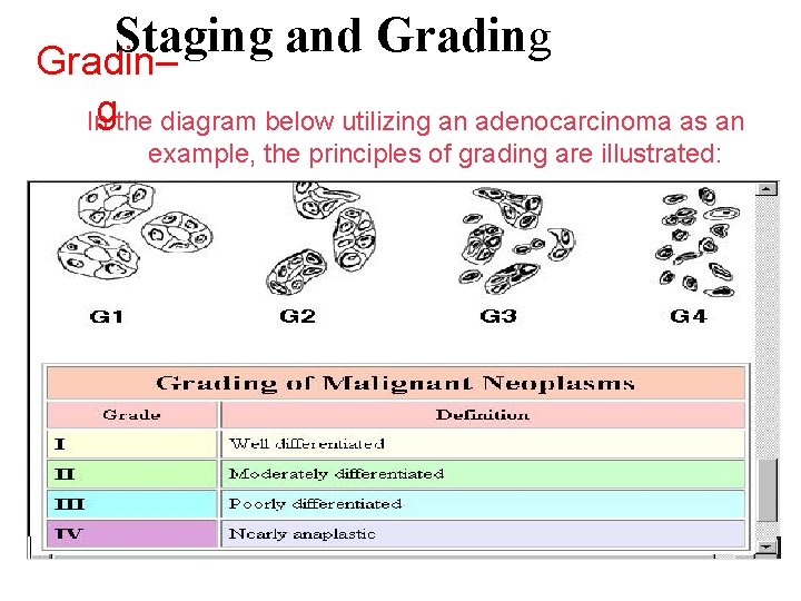 Staging and Grading Gradin– Ingthe diagram below utilizing an adenocarcinoma as an example, the