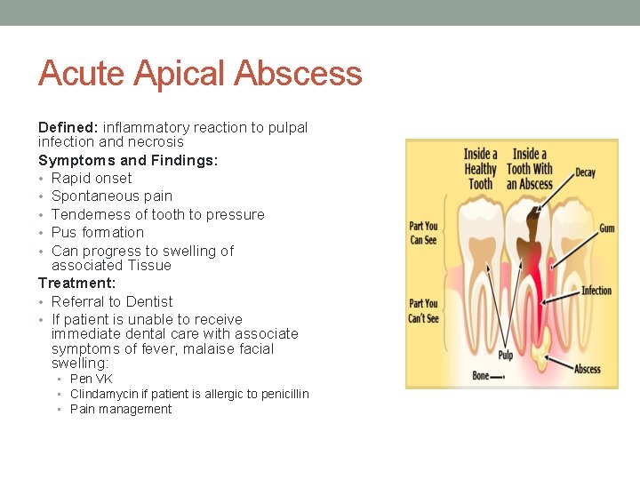 Acute Apical Abscess Defined: inflammatory reaction to pulpal infection and necrosis Symptoms and Findings: