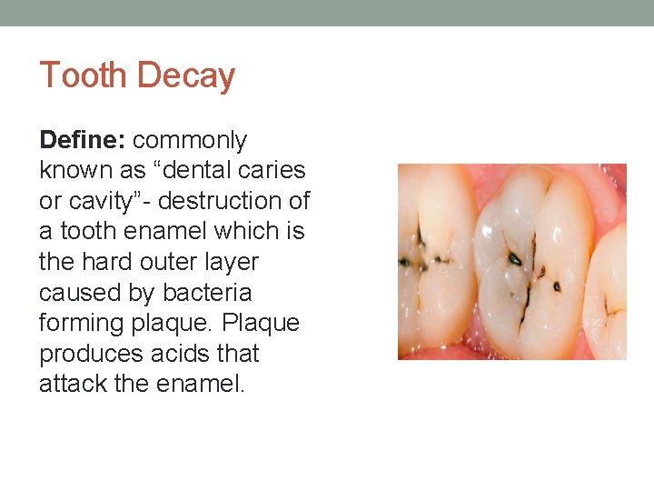 Tooth Decay Define: commonly known as “dental caries or cavity”- destruction of a tooth