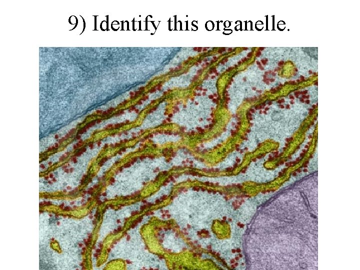 9) Identify this organelle. 