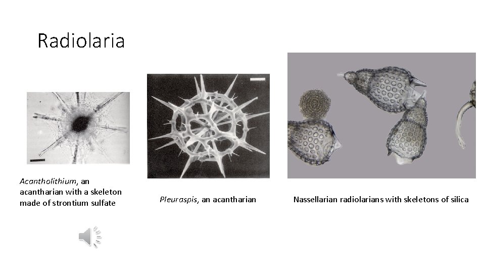 Radiolaria Acantholithium, an acantharian with a skeleton made of strontium sulfate Pleuraspis, an acantharian