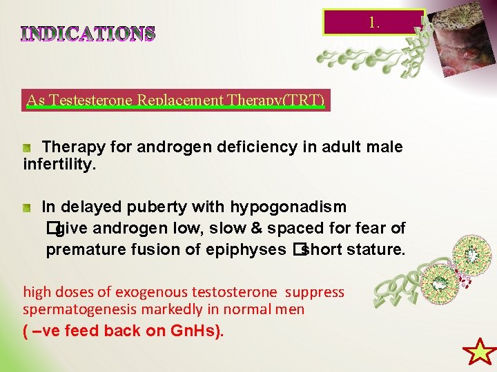 INDICATIONS 1. ANDROGE NS As Testesterone Replacement Therapy(TRT) Therapy for androgen deficiency in adult
