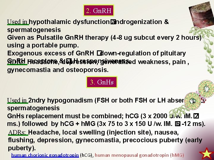 2. Gn. RH Used in hypothalamic dysfunction� androgenization & spermatogenesis Given as Pulsatile Gn.