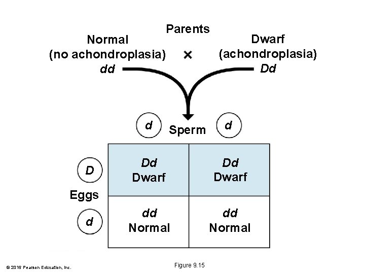 Parents Normal (no achondroplasia) dd d D Sperm Dwarf (achondroplasia) Dd d Dd Dwarf