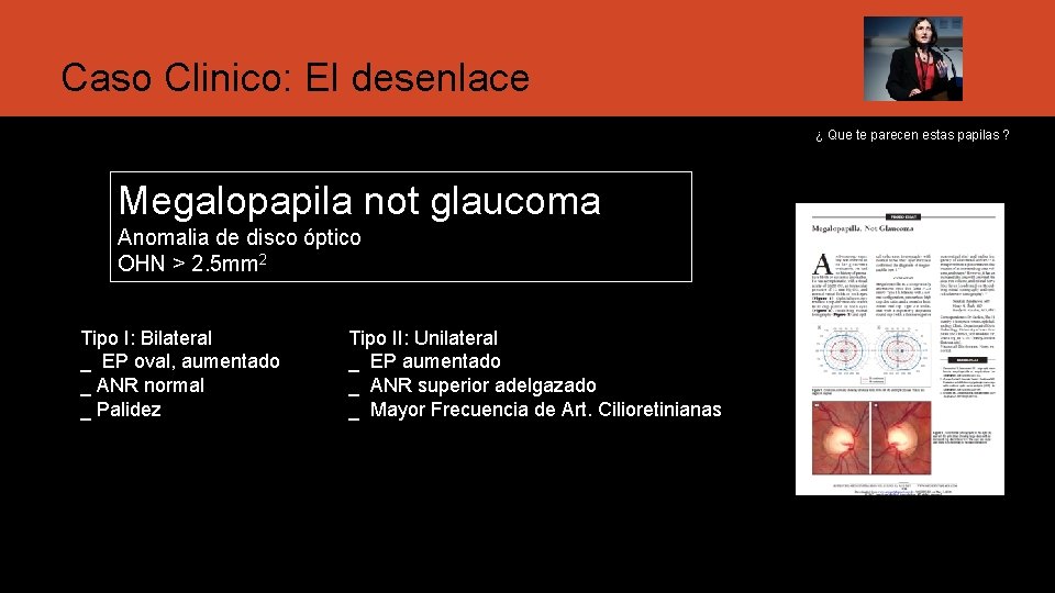 Caso Clinico: El desenlace ¿ Que te parecen estas papilas ? Megalopapila not glaucoma