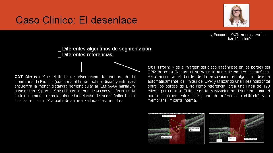 Caso Clinico: El desenlace ¿ Porque las OCTs muestran valores tan diferentes? _ Diferentes