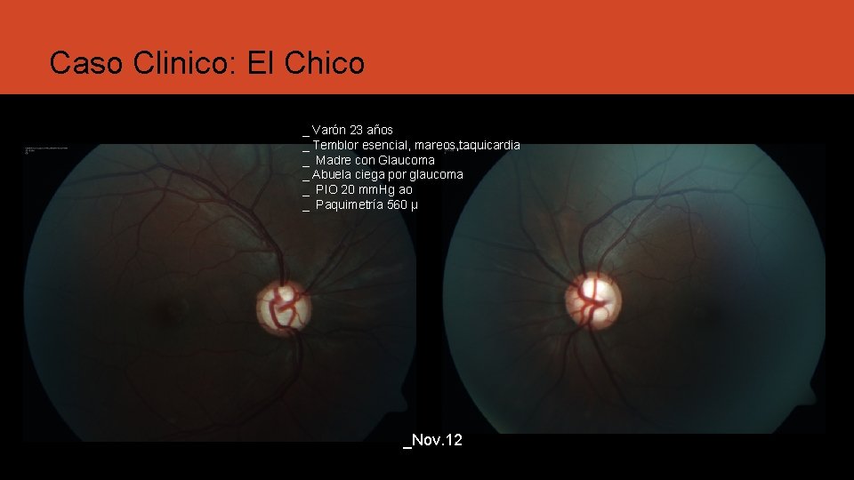 Caso Clinico: El Chico _ Varón 23 años _ Temblor esencial, mareos, taquicardia _