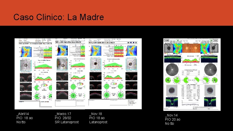 Caso Clinico: La Madre _Abril 14 PIO 18 ao No tto _Marzo. 17 PIO