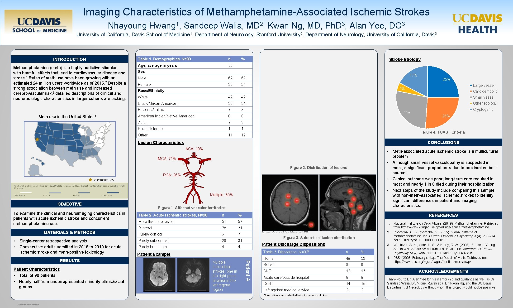 Imaging Characteristics of Methamphetamine-Associated Ischemic Strokes Nhayoung Hwang 1, Sandeep Walia, MD 2, Kwan
