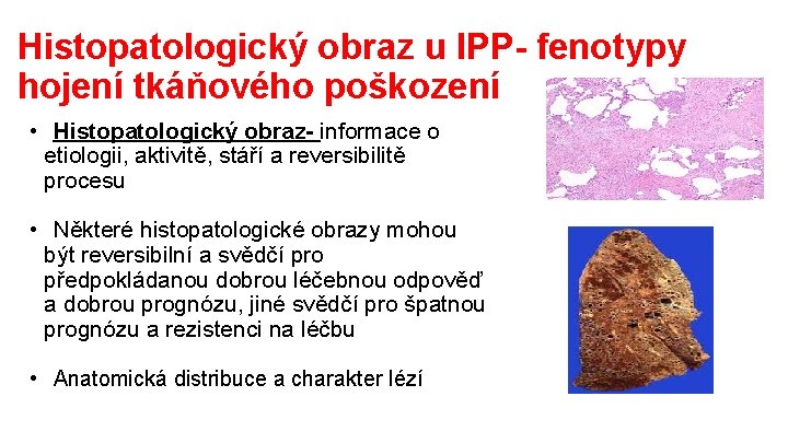 Histopatologický obraz u IPP- fenotypy hojení tkáňového poškození • Histopatologický obraz- informace o etiologii,