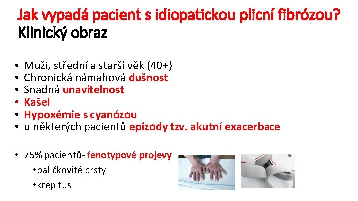 Jak vypadá pacient s idiopatickou plicní fibrózou? Klinický obraz • • • Muži, střední