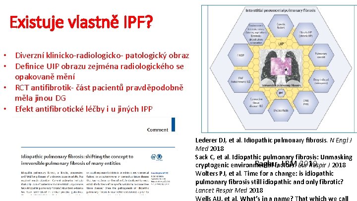 Existuje vlastně IPF? • Diverzní klinicko-radiologicko- patologický obraz • Definice UIP obrazu zejména radiologického