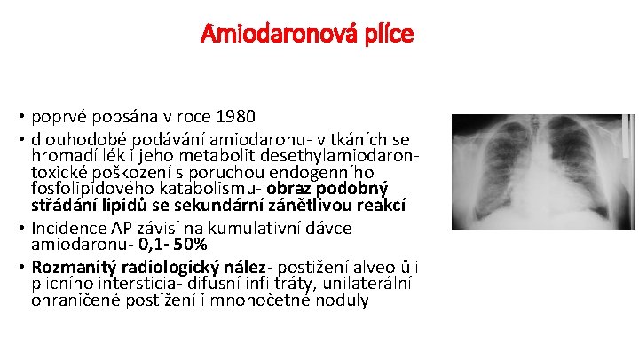 Amiodaronová plíce • poprvé popsána v roce 1980 • dlouhodobé podávání amiodaronu- v tkáních