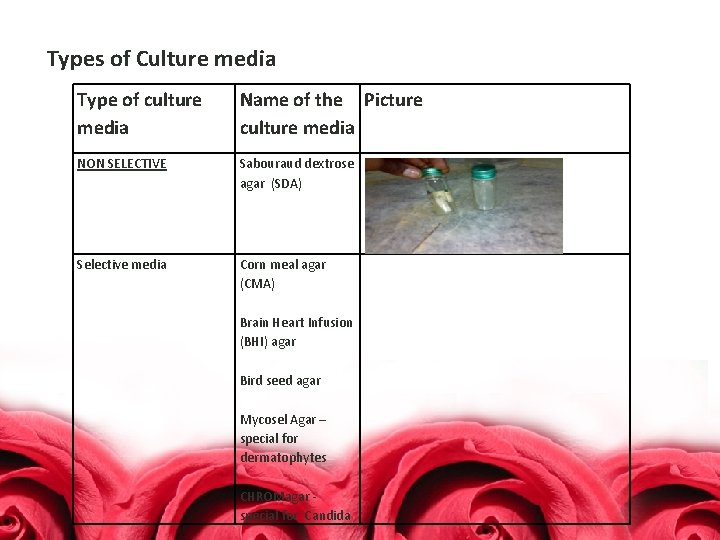 Types of Culture media Type of culture media Name of the Picture culture media