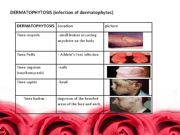 DERMATOPHYTOSIS (infection of dermatophytes) DERMATOPHYTOSIS Location Tinea corporis - small lesions occurring anywhere on