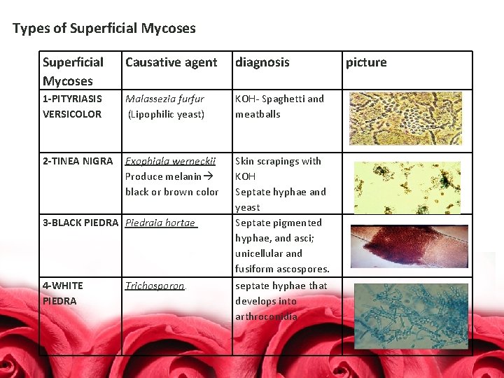 Types of Superficial Mycoses Causative agent diagnosis 1 -PITYRIASIS VERSICOLOR Malassezia furfur (Lipophilic yeast)