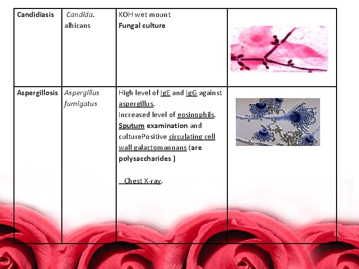 Candidiasis Candida. albicans Aspergillosis Aspergillus fumigatus KOH wet mount Fungal culture High level of