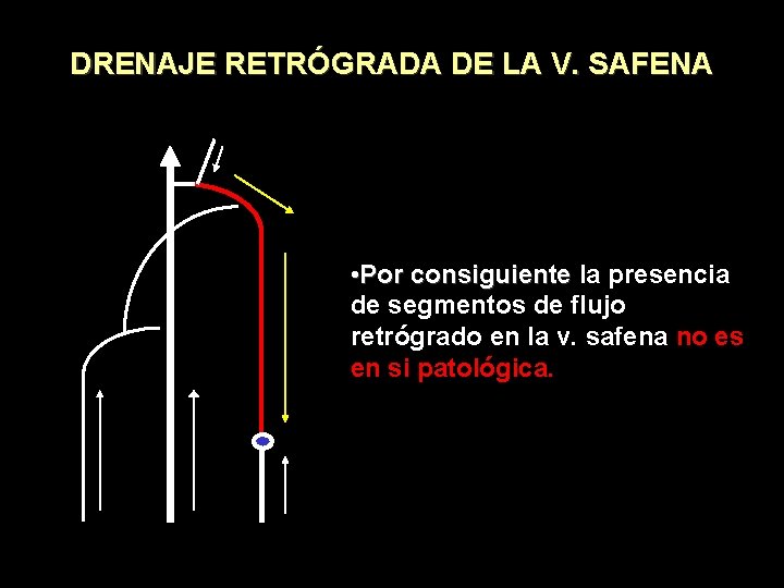 DRENAJE RETRÓGRADA DE LA V. SAFENA • Por consiguiente la presencia de segmentos de