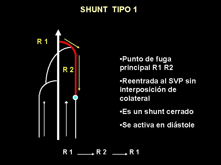 SHUNT TIPO 1 R 1 • Punto de fuga principal R 1 R 2