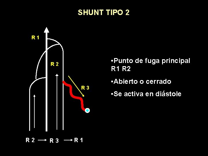 SHUNT TIPO 2 R 1 • Punto de fuga principal R 1 R 2