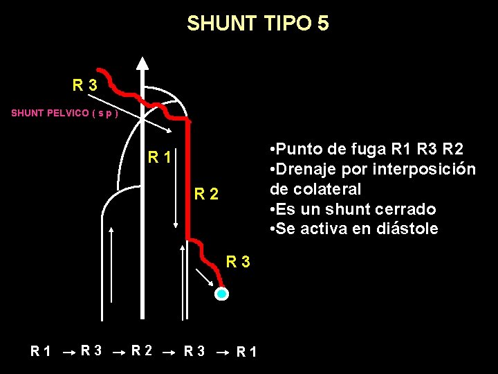SHUNT TIPO 5 R 3 SHUNT PELVICO ( s p ) • Punto de