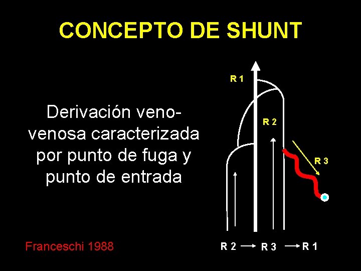 CONCEPTO DE SHUNT R 1 Derivación venosa caracterizada por punto de fuga y punto