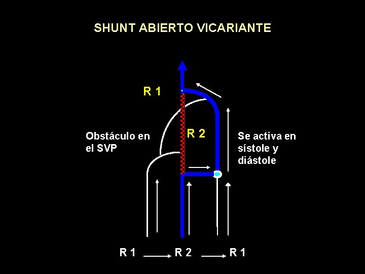 SHUNT ABIERTO VICARIANTE R 1 Obstáculo en el SVP R 1 R 2 Se