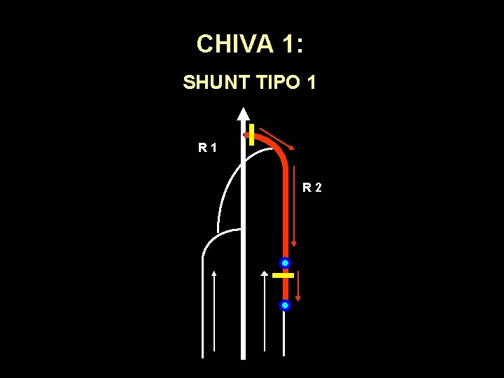 CHIVA 1: SHUNT TIPO 1 R 2 