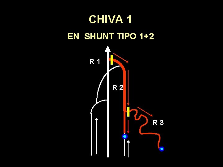 CHIVA 1 EN SHUNT TIPO 1+2 R 1 R 2 R 3 